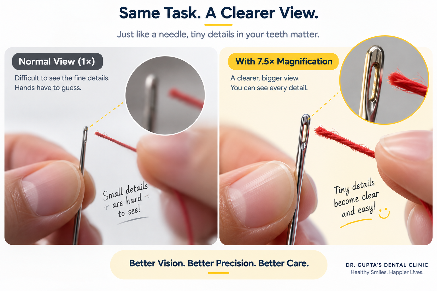 Threading a needle